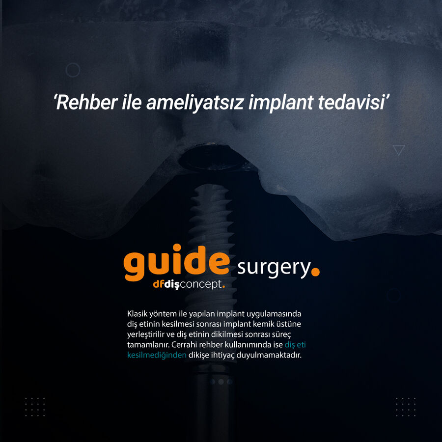 Guide surgery — rehber ile ameliyatsız implant tedavisi